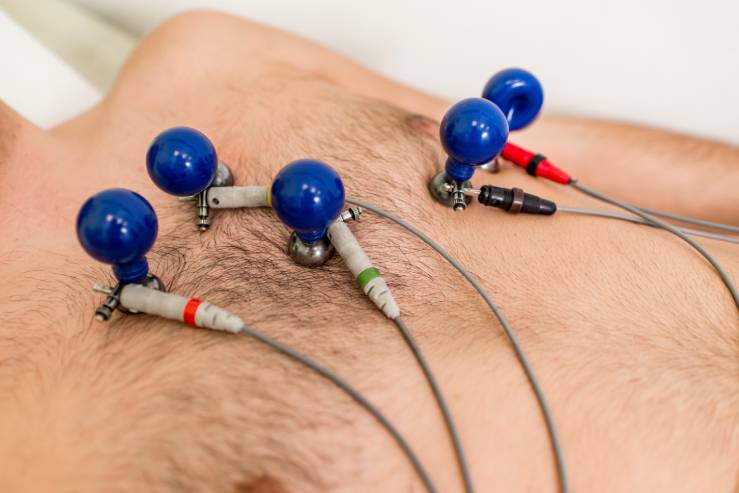 electrical Stimulation